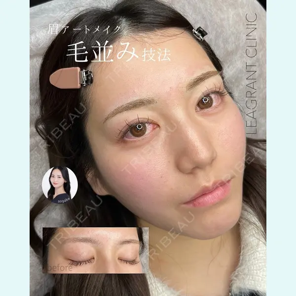 LEAGRANT CLINIC 中目黒の症例