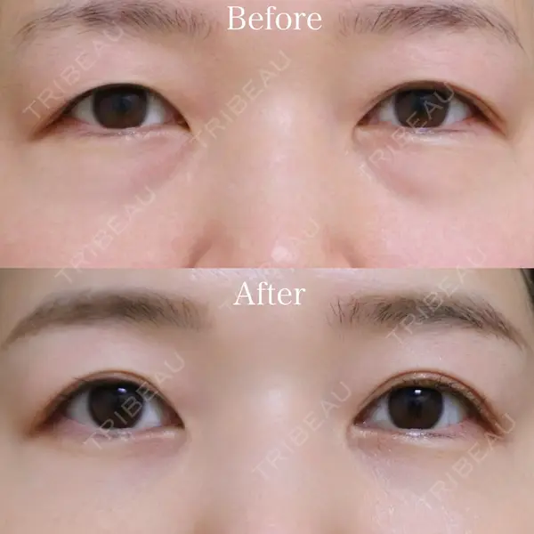 Wクリニック 福岡院の症例