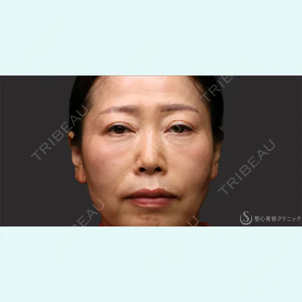 聖心美容クリニック 名古屋院 加藤 大典医師の症例