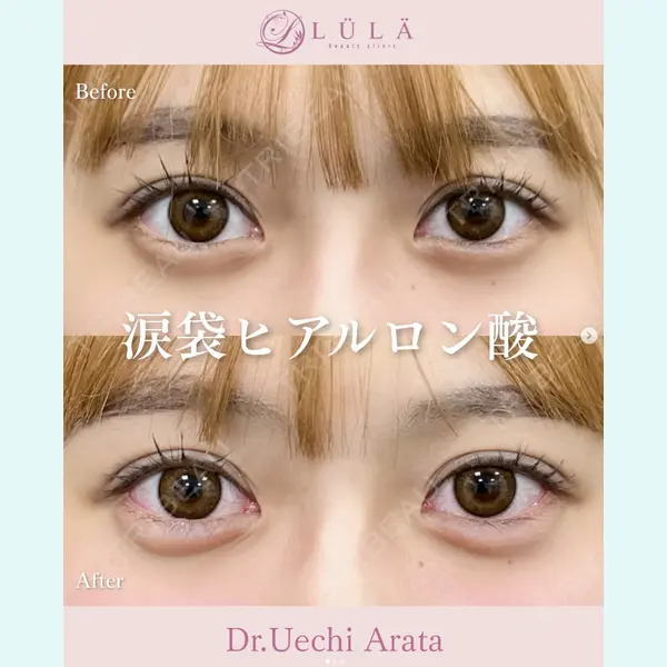 ルラ美容クリニック 上野院 上地 新医師の症例