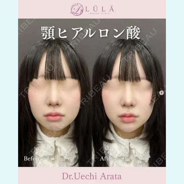 ルラ美容クリニック 上野院 上地 新医師の症例