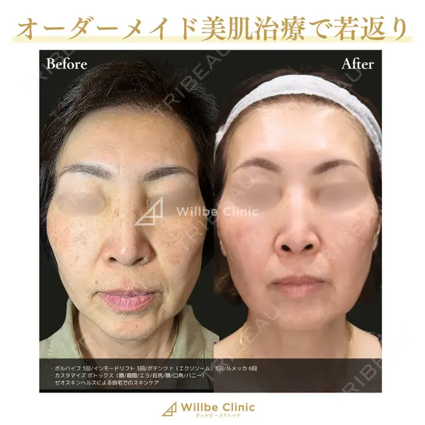 ウィルビークリニック 銀座院 堀田 歩希医師の症例