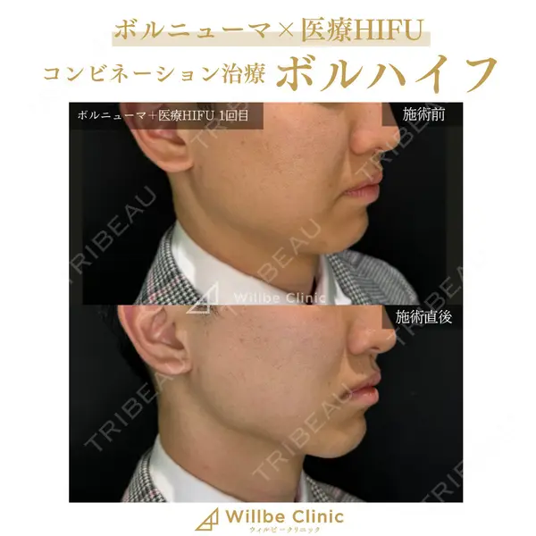 ウィルビークリニック 新宿院の症例