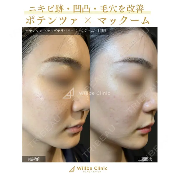 ウィルビークリニック 立川院の症例