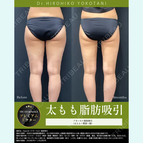 湘南美容クリニック 大阪梅田本院 横谷 仁彦医師の症例