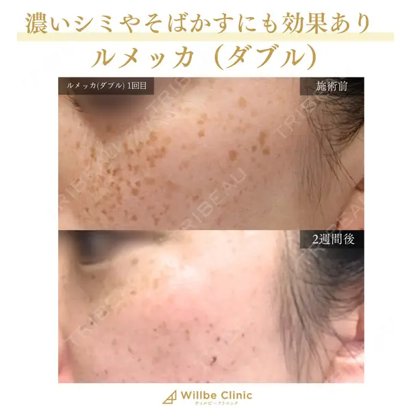 ウィルビークリニック 銀座院の症例