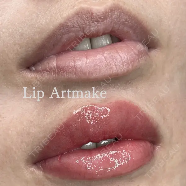 MEMOTO CLINIC 名古屋 宮崎久留明医師の症例