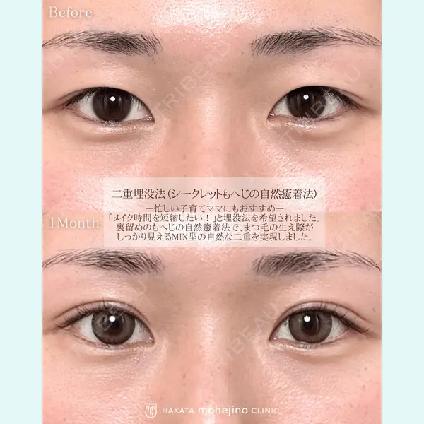 博多もへじのクリニック 村田 将光医師の症例