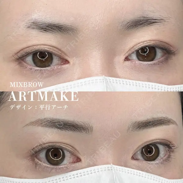 MEMOTO CLINIC 名古屋 宮崎久留明医師の症例