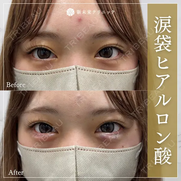 新未来クリニックの症例