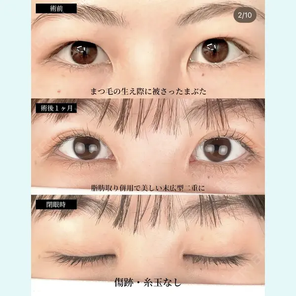 湘南美容クリニック 大阪梅田本院の症例