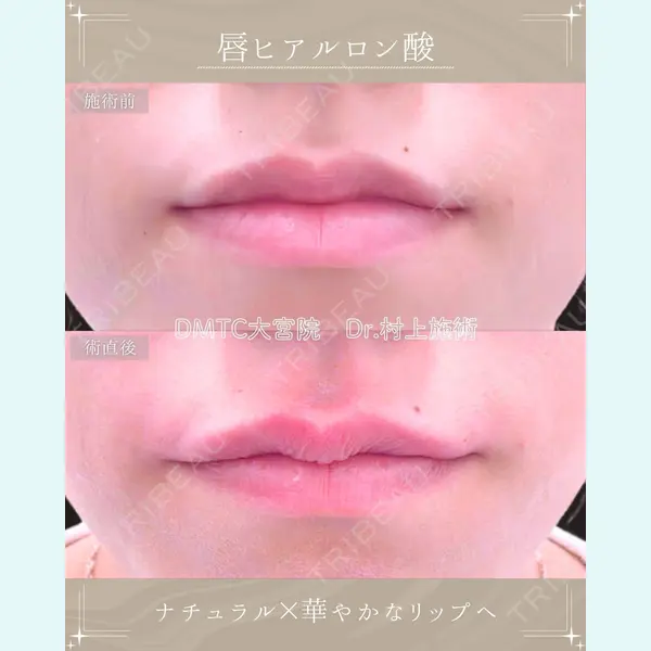 DMTC美容皮膚科 大宮院 村上医師医師の症例