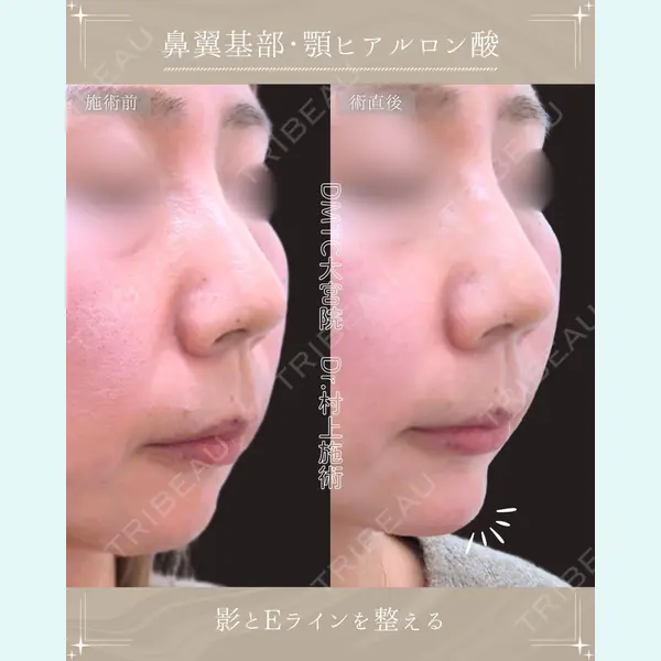 DMTC美容皮膚科 大宮院 村上医師医師の症例