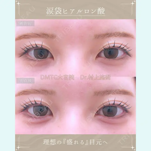 DMTC美容皮膚科 大宮院 村上医師医師の症例