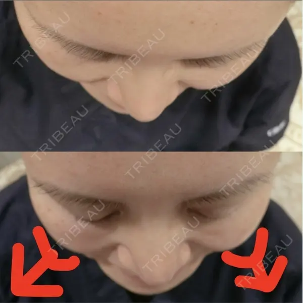 やさしい美容皮膚科・皮フ科　東京浅草院の症例