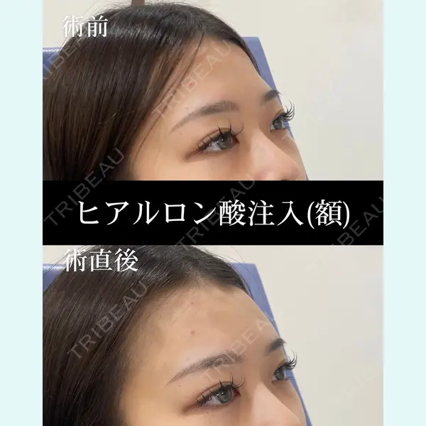 HAAB×DREAM BEAUTY CLINIC 大阪梅田院 錦 実奈医師の症例