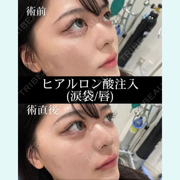 HAAB×DREAM BEAUTY CLINIC 大阪梅田院 錦 実奈医師の症例