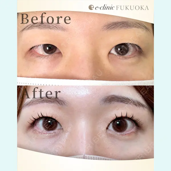 eクリニック 福岡院の症例