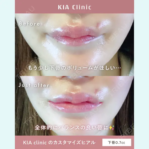 KIA CLINIC 心斎橋院 雲山　盛秀医師の症例