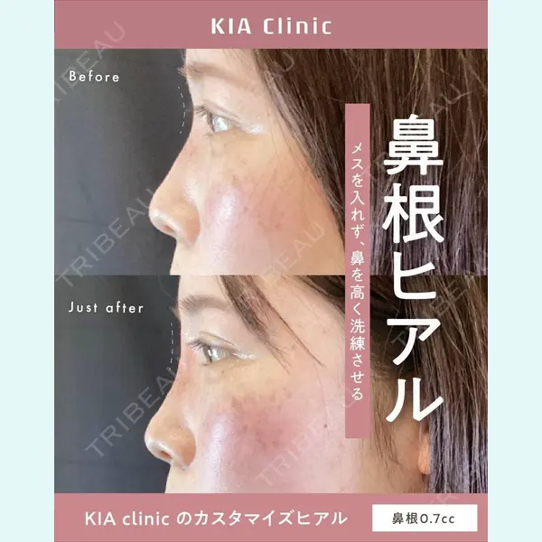 KIA CLINIC 心斎橋院 雲山　盛秀医師の症例