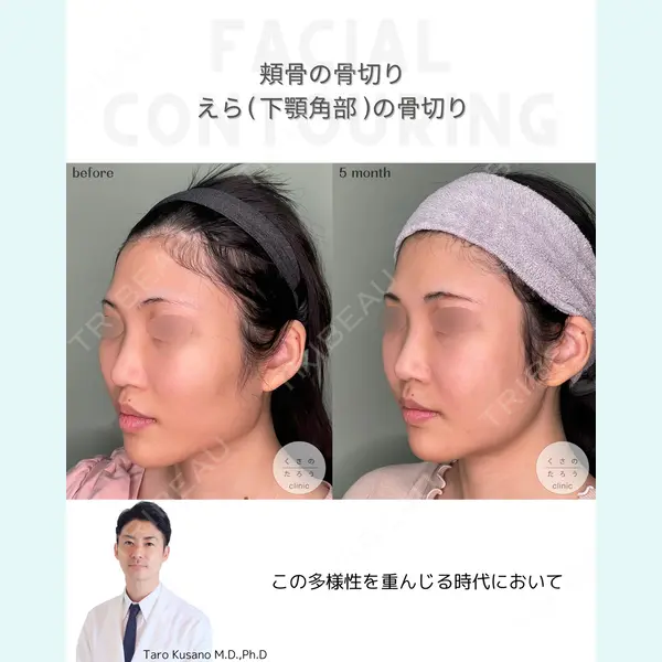 くさのたろうクリニック 草野 太郎医師の症例