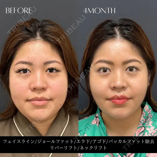 RIVER CLINIC（リバークリニック）の症例