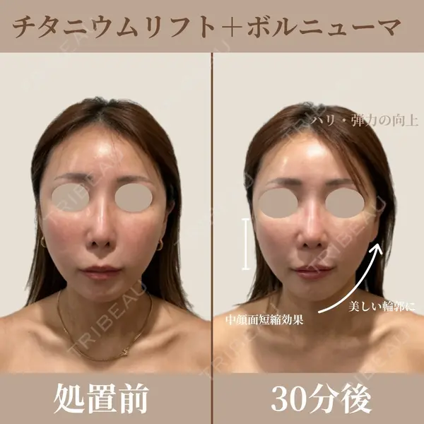 ビューティー和心クリニック 浅草院の症例