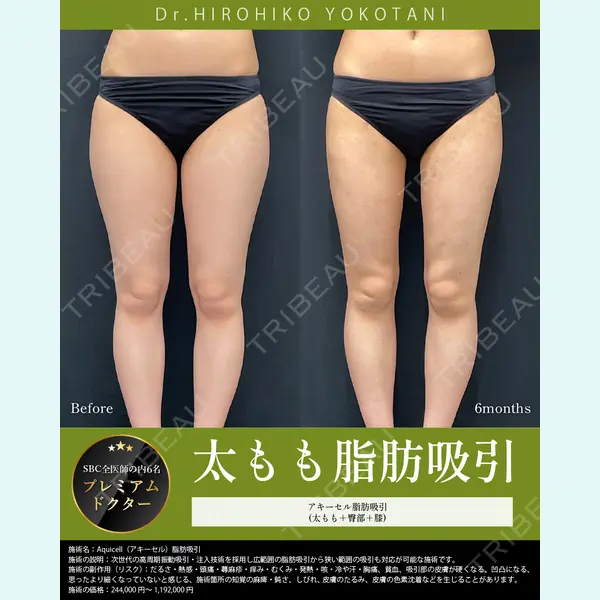 湘南美容クリニック 大阪梅田本院 横谷 仁彦医師の症例