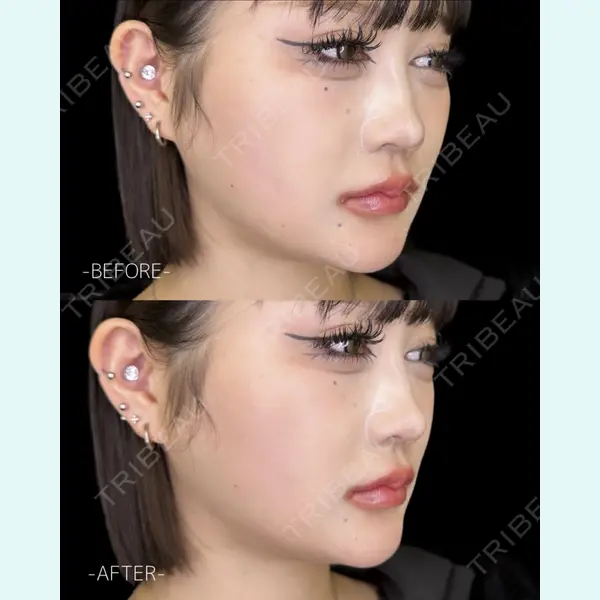 ルラ美容クリニック 大宮院 / ルラスキンクリニック 大宮院 右京 大季医師の症例