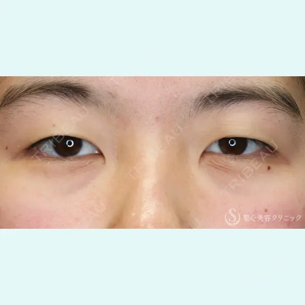 聖心美容クリニック 名古屋院 加藤 大典医師の症例