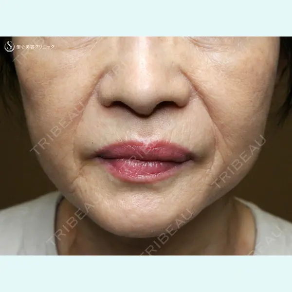 聖心美容クリニック 札幌院 前多 一彦医師の症例