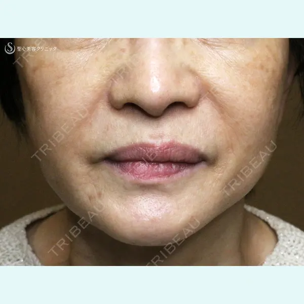 聖心美容クリニック 札幌院 前多 一彦医師の症例