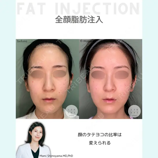 くさのたろうクリニック 下山　真実医師の症例