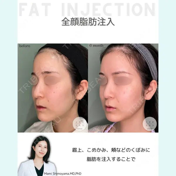 くさのたろうクリニック 下山　真実医師の症例