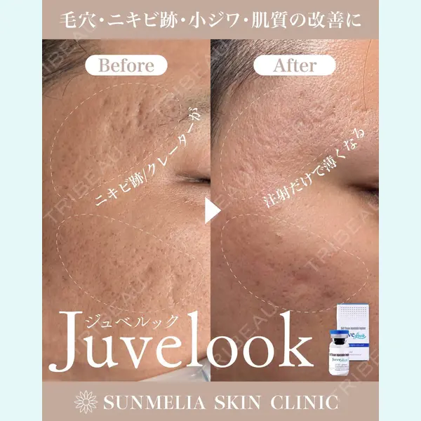 SUNMELIA SKIN CLINICの症例