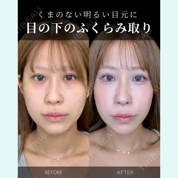 ルラ美容クリニック 大宮院 / ルラスキンクリニック 大宮院の症例