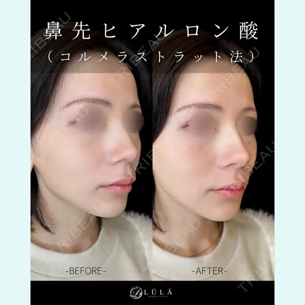ルラ美容クリニック 大宮院 / ルラスキンクリニック 大宮院の症例