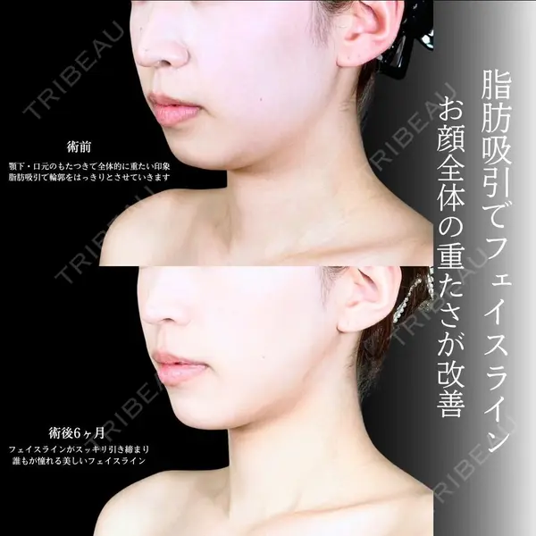 アリエル美容クリニック 横浜院 渡邉 光医師の症例