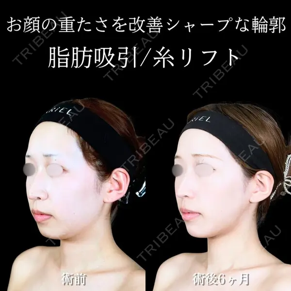 アリエル美容クリニック 横浜院 渡邉 光医師の症例