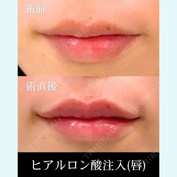 HAAB×DREAM BEAUTY CLINIC 東京本院 齋藤 丈瑠医師の症例