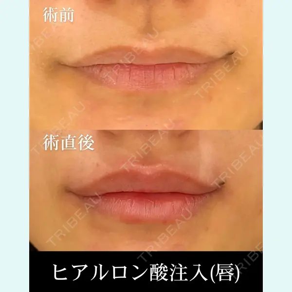 HAAB×DREAM BEAUTY CLINIC 東京本院 齋藤 丈瑠医師の症例