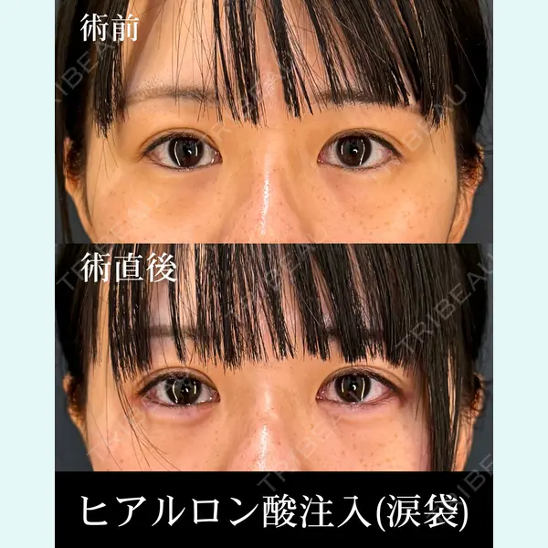 HAAB×DREAM BEAUTY CLINIC 東京本院 齋藤 丈瑠医師の症例