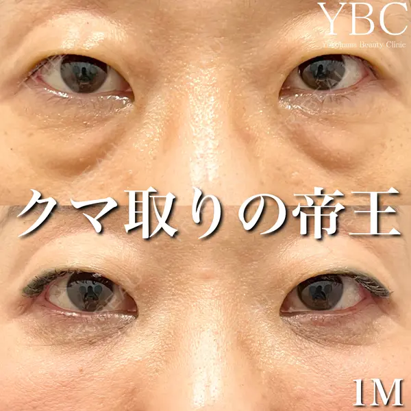 YBC横浜美容外科 大宮院 磯村 亮輔医師の症例