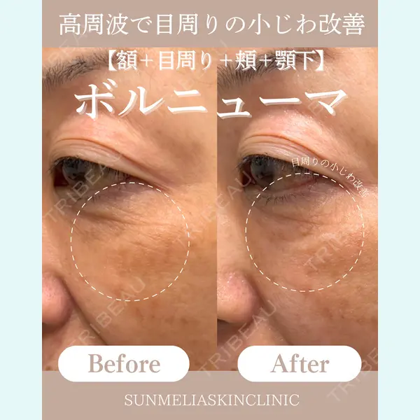 SUNMELIA SKIN CLINICの症例