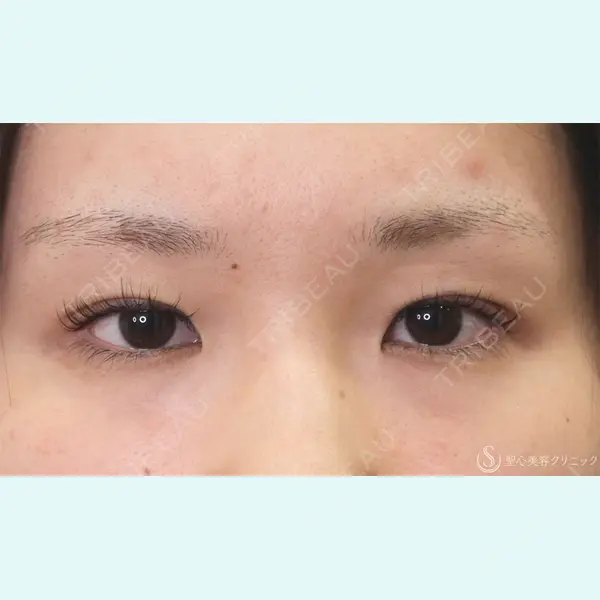 聖心美容クリニック 福岡院 美原 寿之医師の症例