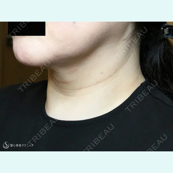 聖心美容クリニック 札幌院 前多 一彦医師の症例