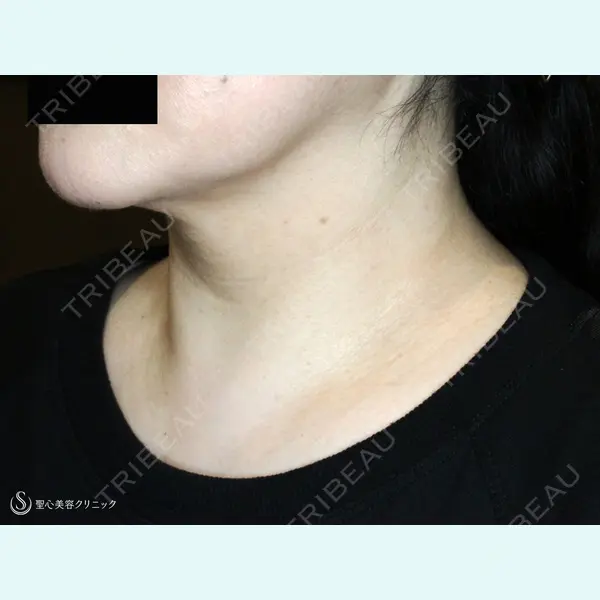 聖心美容クリニック 札幌院 前多 一彦医師の症例