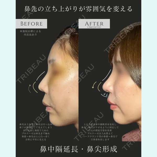 eクリニック 名古屋院 服部 健人医師の症例