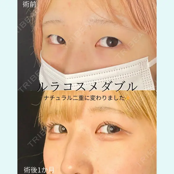 ルラ美容クリニック 仙台院 / ルラスキンクリニック 仙台院 橋本 英樹医師の症例