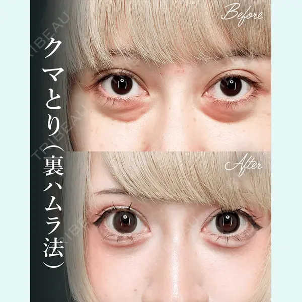 Tokyo Tensei Clinic 新宿院 桂田 凛医師の症例